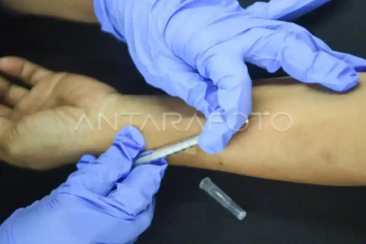 BPOM Catat Izin Edar 43 Obat TBC dalam Periode 2024–2026