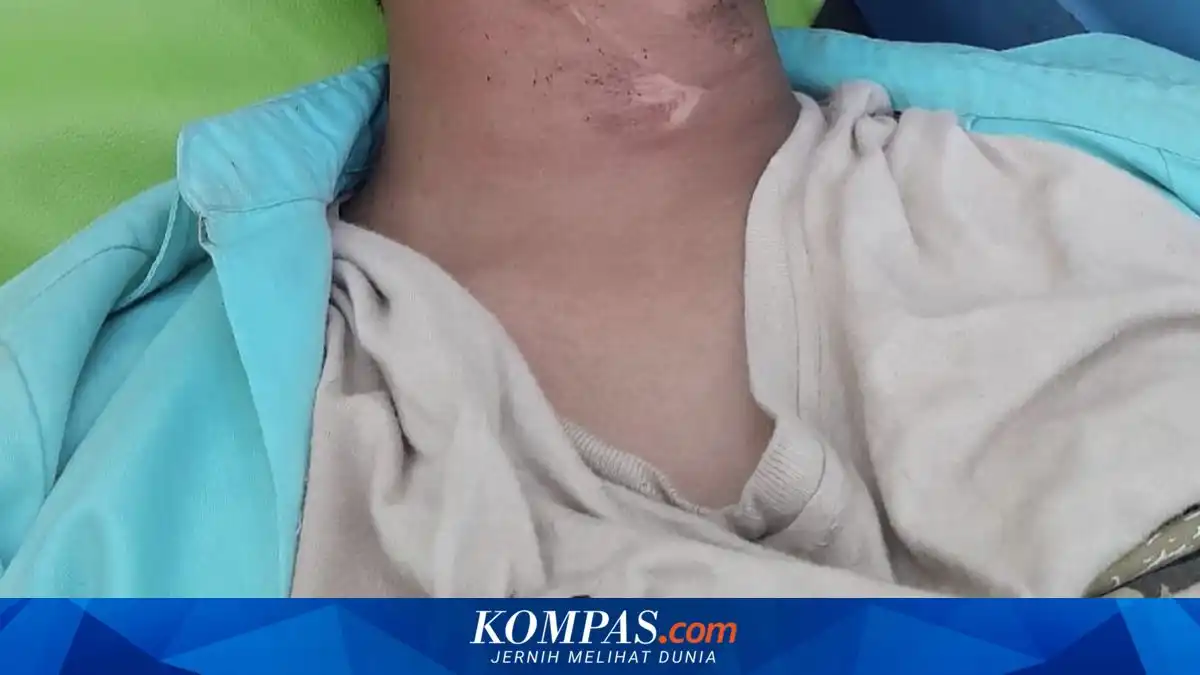 Siswa SMAN 2 Bangkalan Terluka Setelah Terjerat Kabel di Area Proyek Gorong-Gorong